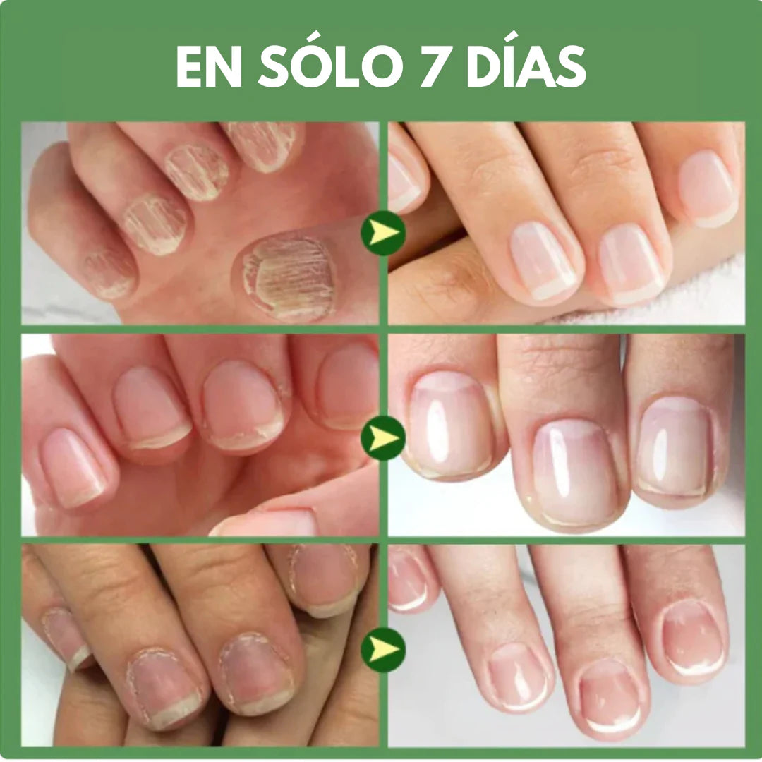 💅COMBO BASES ENDURECEDORA UÑAS DE TITANIO x 3